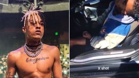 xxxtentaction autopsy photos|X’s autopsy : r/XXXTENTACION